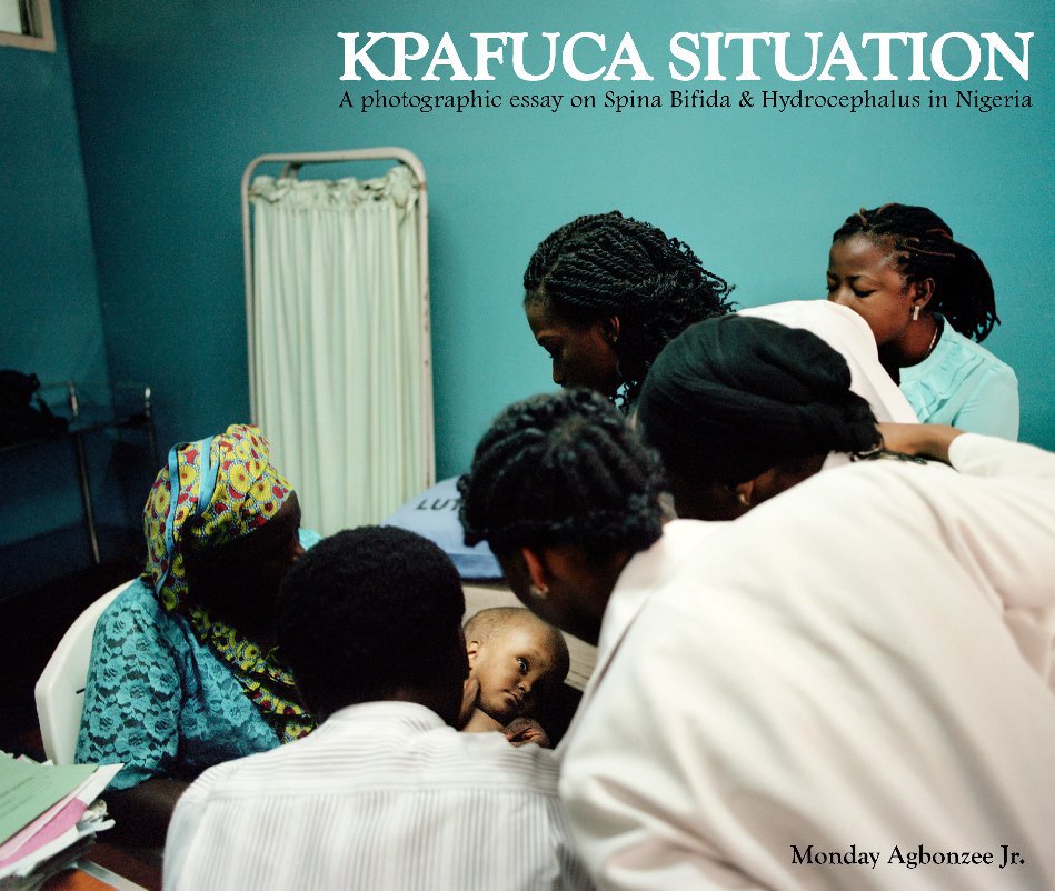 View Kpafuca Situation by Monday Agbonzee Jr.