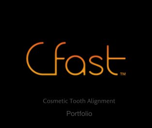 Cosmetic Tooth Alignment book cover