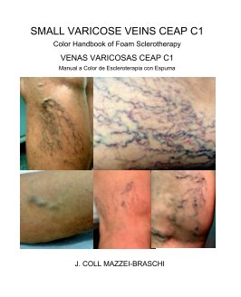 Small Varicose Veins CEAP C1. Varices book cover