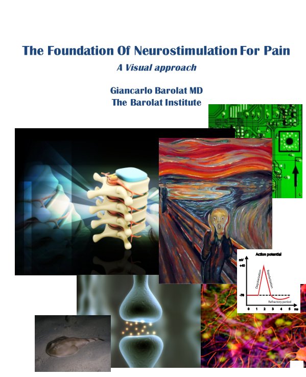 Ver The Foundation of Neurostimulation for Pain por Giancarlo Barolat