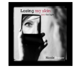 Losing My Skin - Into the light book cover