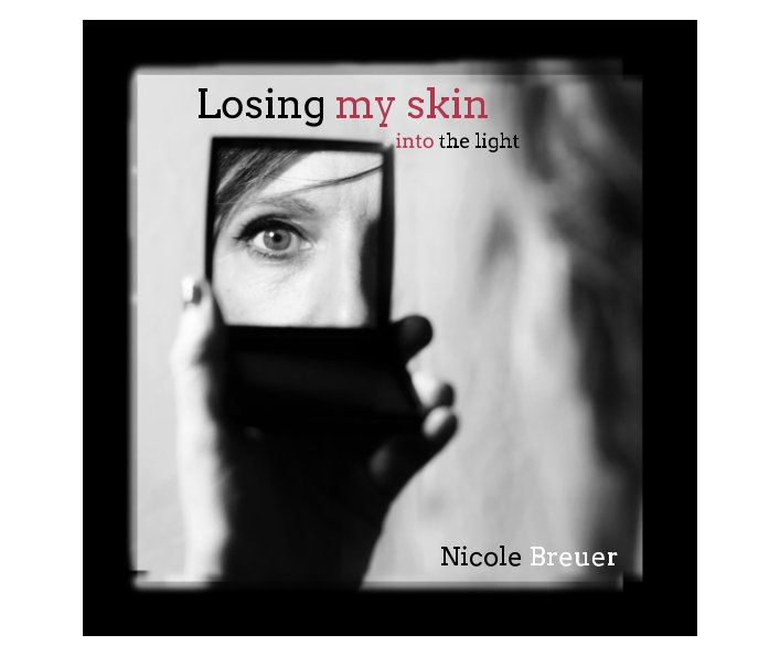 View Losing My Skin - Into the light by Nicole Breuer