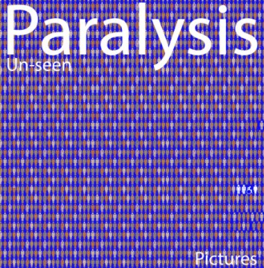 Paralysis Unseen book cover