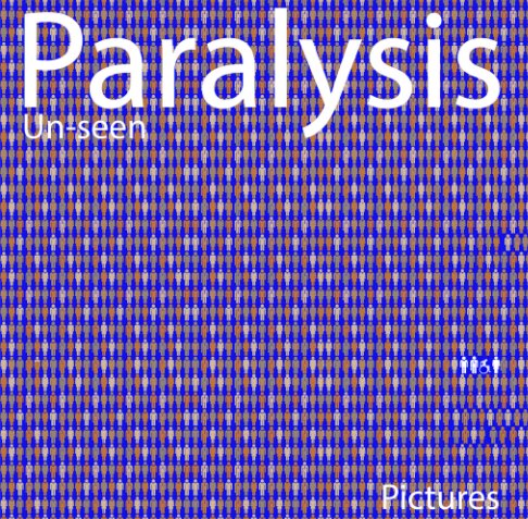 View Paralysis Unseen by Peter Mansell