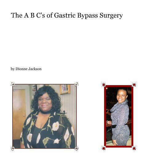 View The A B C's of Gastric Bypass Surgery by Dionne Jackson