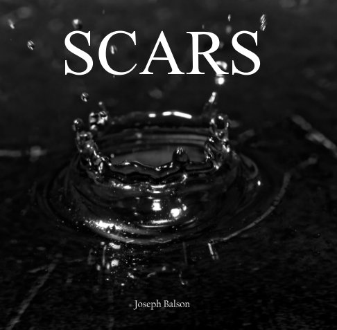 View Scars by Joseph Balson