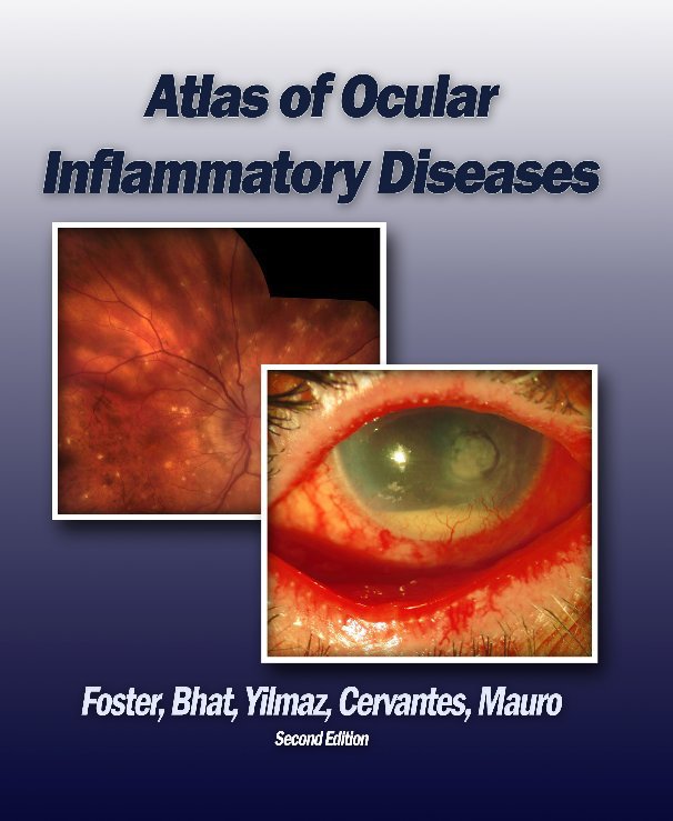 Ver Atlas of Ocular Inflammatory Diseases por Foster, Bhat, Yilnaz, Cervantes, Mauro