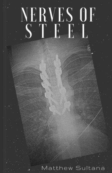 View Nerves of Steel by Matthew Sultana