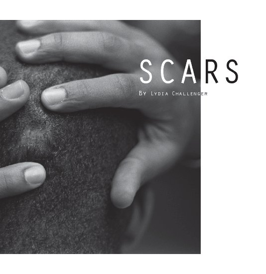 View Scars by Lydia Challenger