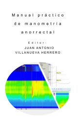 Manual Práctico de Manometría Anorrectal book cover