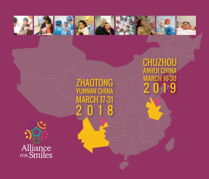 View Zhaotong and Chuzhou 2018-19 by Alliance for Smiles