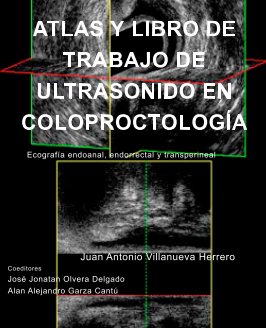Atlas y Libro de Trabajo de Ultrasonido en Coloproctología book cover