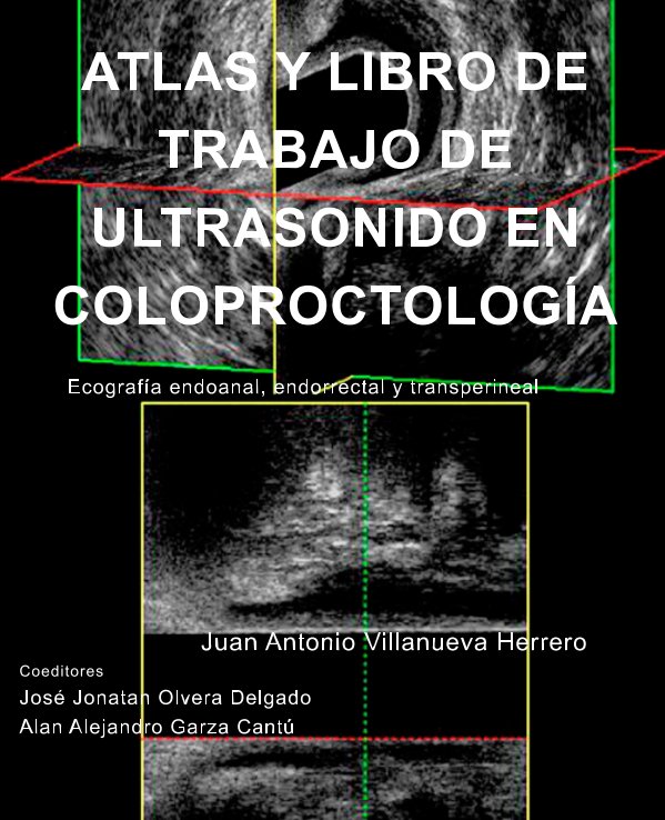 Visualizza Atlas y Libro de Trabajo de Ultrasonido en Coloproctología di Juan A. Villanueva Herrero