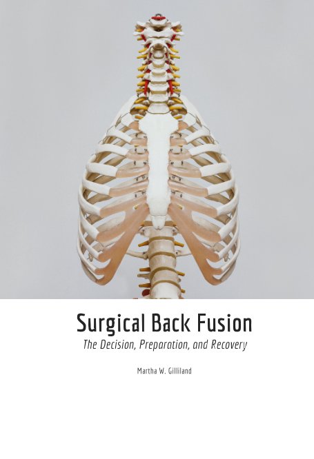 View Surgical Back Fusion by Martha Gilliland