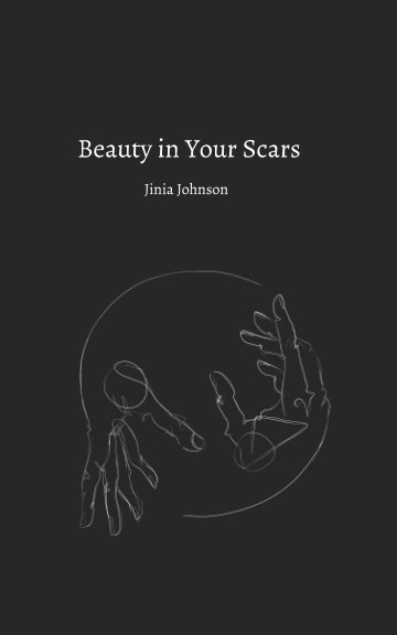 View Beauty In Your Scars by Jinia Johnson