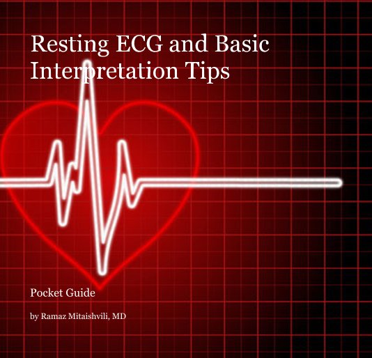 View Resting ECG and Basic Interpretation Tips by Ramaz Mitaishvili, MD