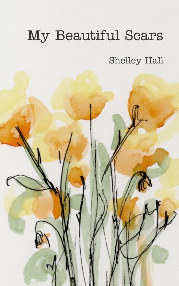 View My Beautiful Scars by Shelley Hall