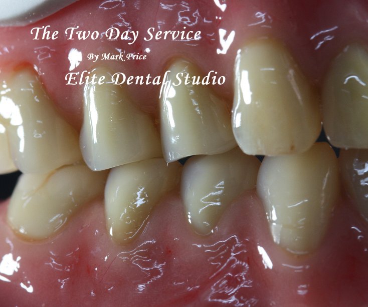 Bekijk The Two Day Service op Elite Dental Studio