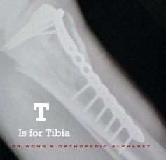 T Is for Tibia book cover