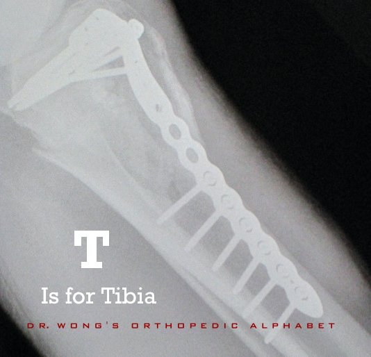View T Is for Tibia by Spencer Wynn