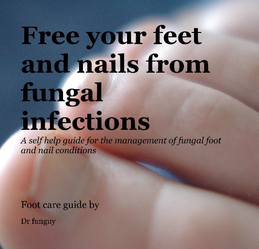 Free your feet and nails from fungal infections A self help guide for ...