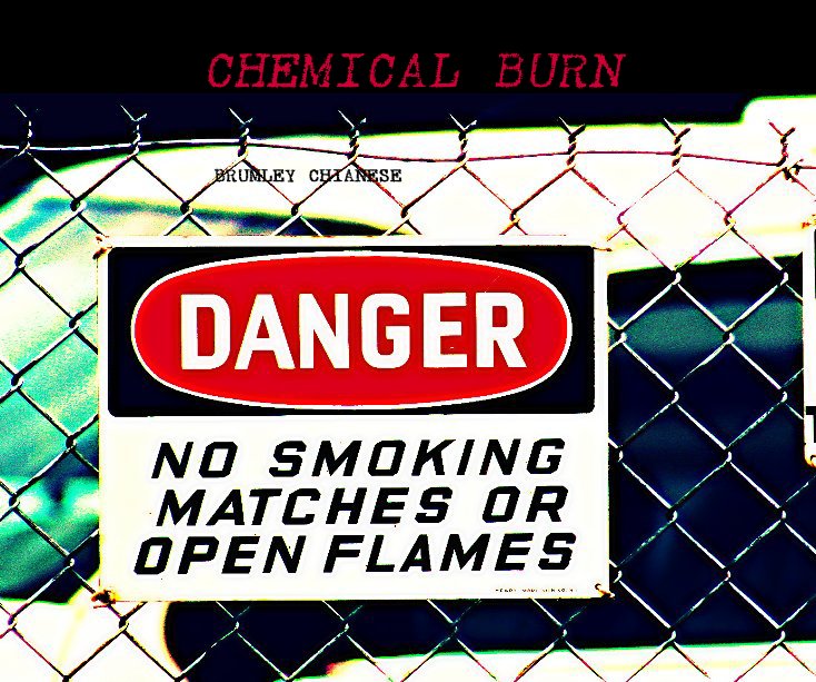 View CHEMICAL BURN by BRUMLEY CHIANESE