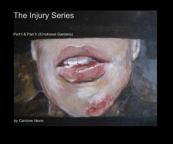 View The Injury Series by Caroline Nevin