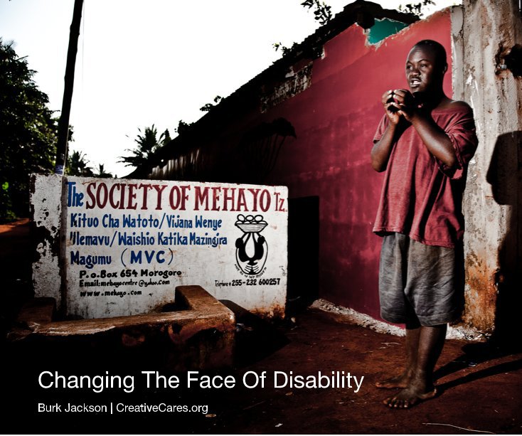 Ver Changing The Face Of Disability por Burk Jackson | CreativeCares.org