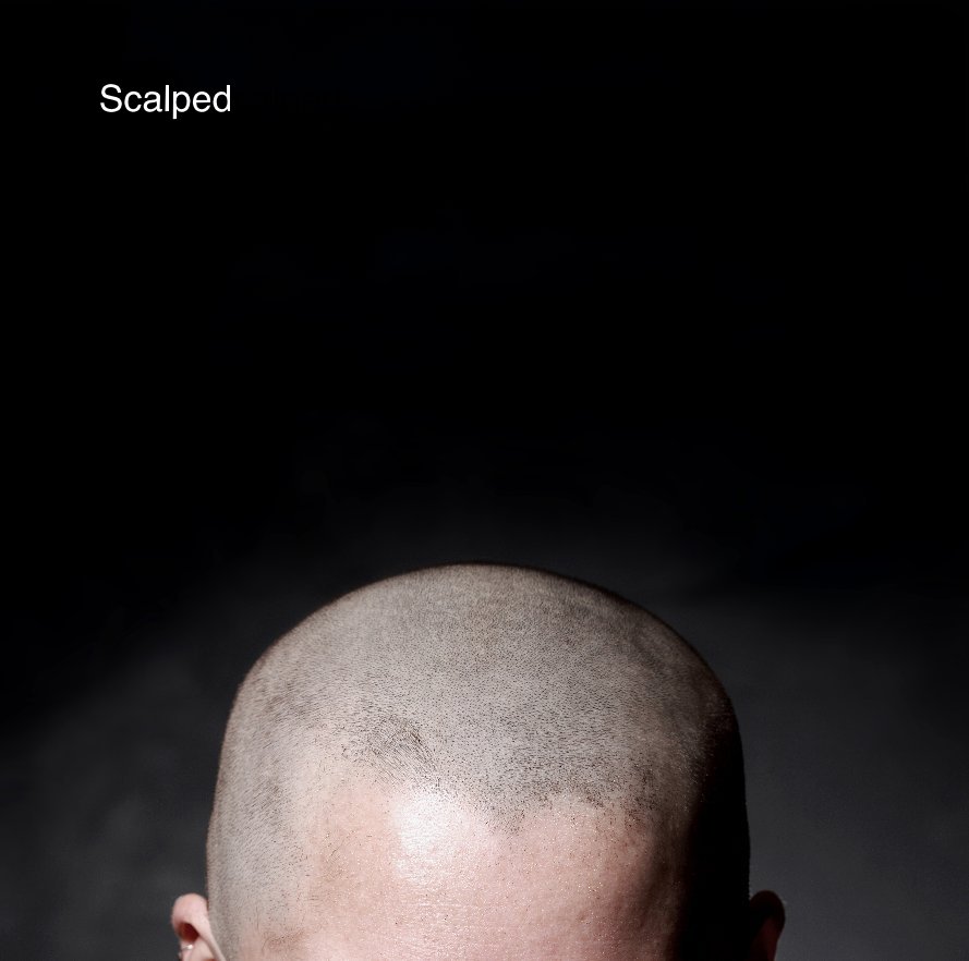 View Scalped by Dónal Moloney