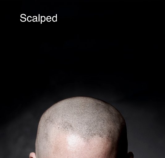 View Scalped by Dónal Moloney
