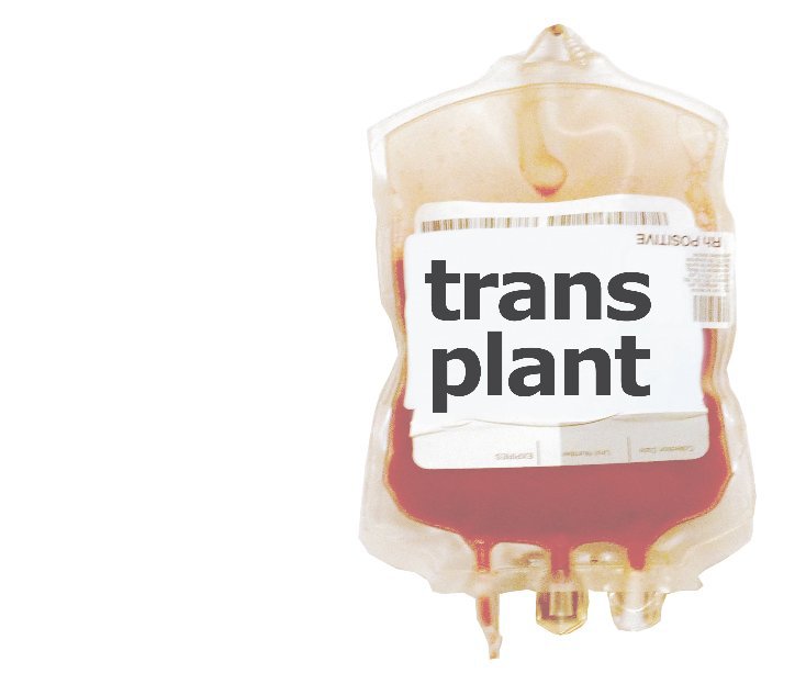 Ver transplant por AnitaM