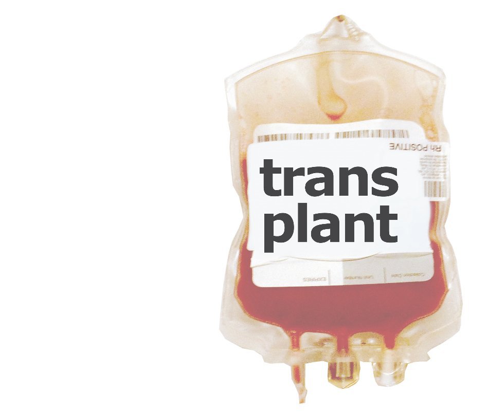 Visualizza Transplant di AnitaM