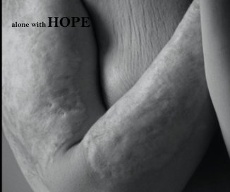 alone with HOPE book cover