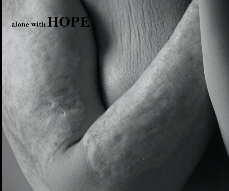 Ver alone with HOPE por Jennifer Brucker