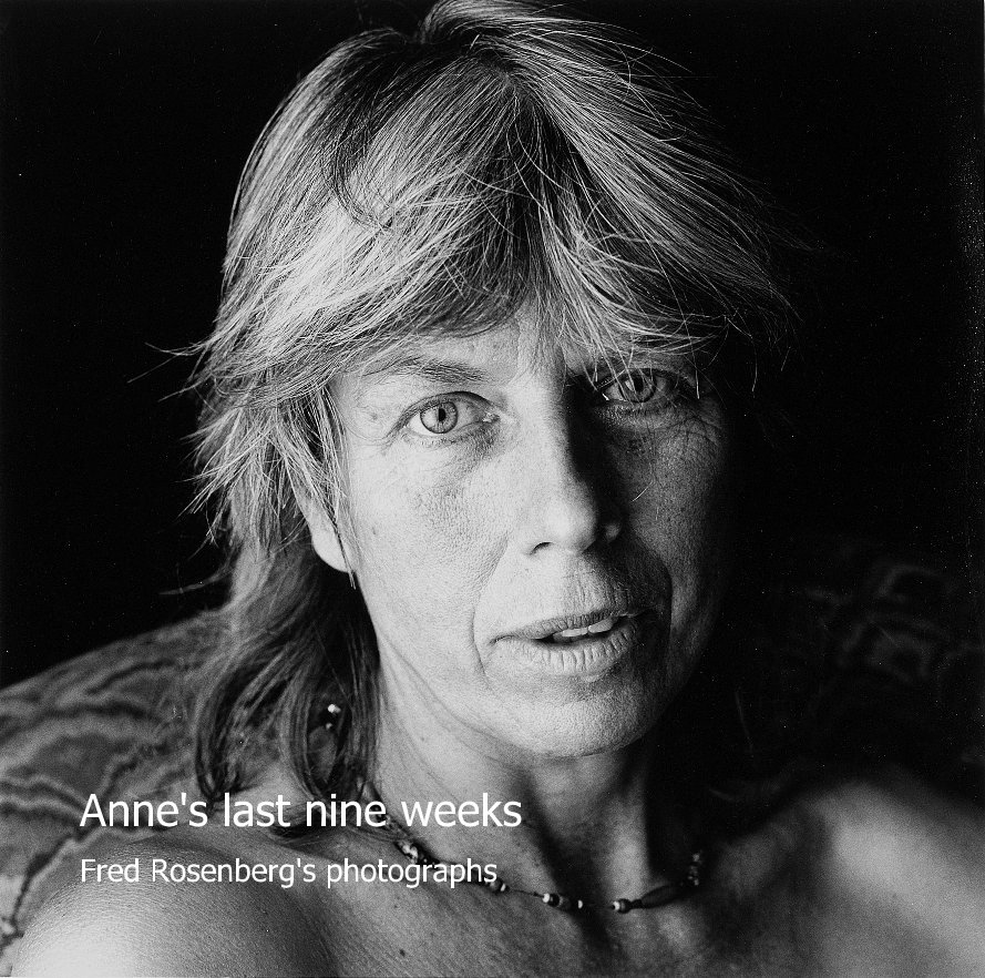 Ver Anne's last nine weeks por Fred Rosenberg's photographs