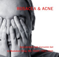 ROSACEA & ACNE book cover
