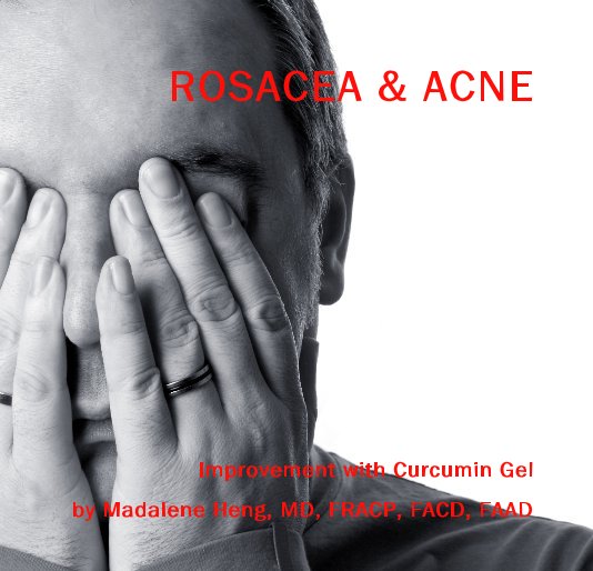 View ROSACEA & ACNE by Madalene Heng, MD, FRACP, FACD, FAAD