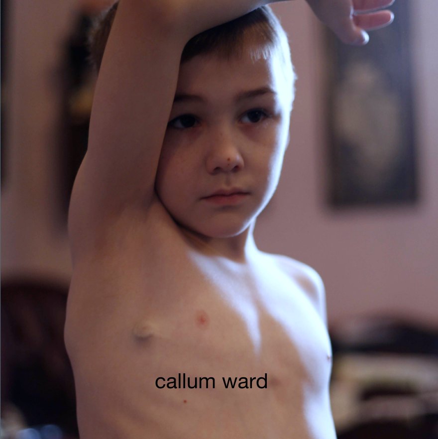 Ver living with cystic fibrosis por George Ward