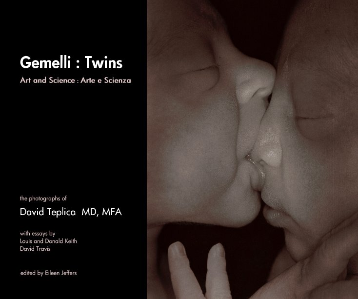 Ver Gemelli : Twins por David Teplica MD, MFA