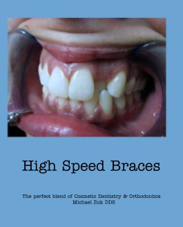 High Speed Braces book cover