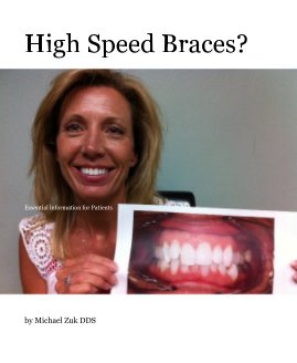 High Speed Braces? book cover