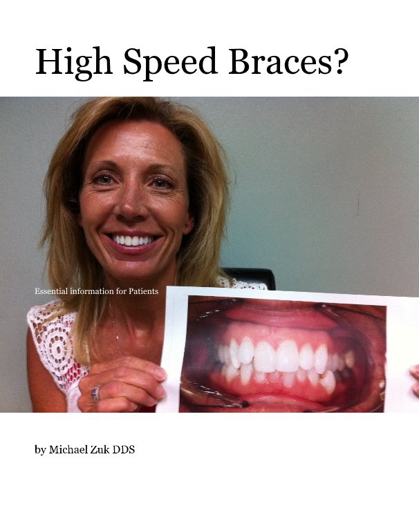 View High Speed Braces? by Michael Zuk DDS