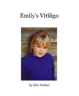 Emily's Vitiligo book cover