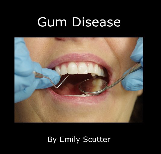 View Gum Disease by Emily Scutter