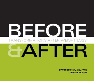 Before & After: Transformations After Weight Loss book cover