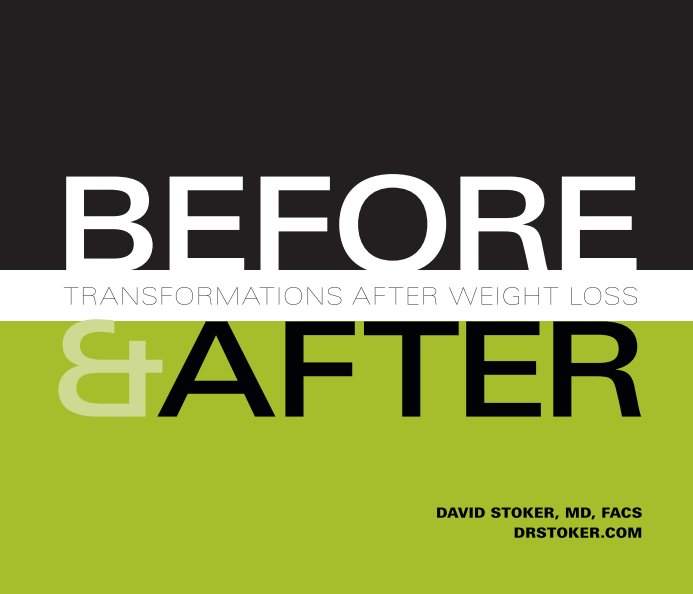 View Before & After: Transformations After Weight Loss by David Stoker, MD, FACS