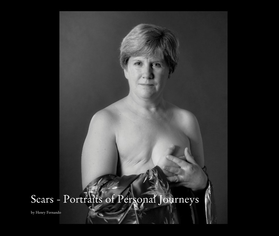 View Scars - Portraits of Personal Journeys by Henry Fernando