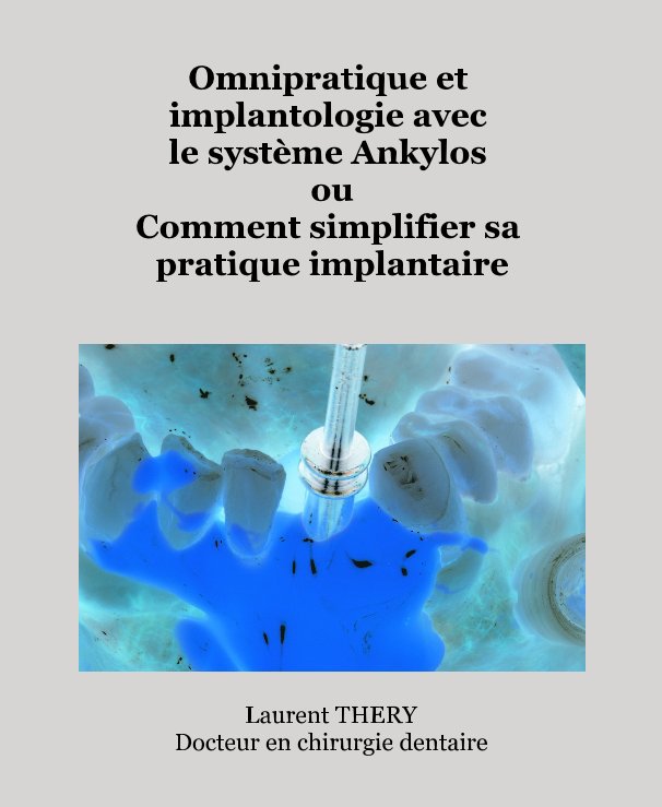 View Omnipratique et implantologie avec le système Ankylos ou Comment simplifier sa pratique implantaire by Laurent THERY Docteur en chirurgie dentaire