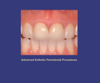 Advanced Esthetic Periodontal Procedures book cover