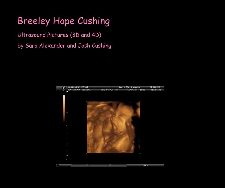 View Breeley Hope Cushing by Sara Alexander and Josh Cushing